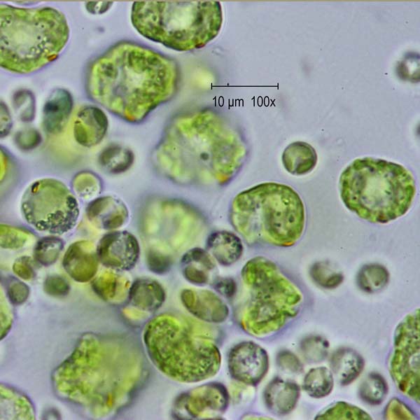 Altro da determinare